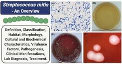 Streptococcus mitis- An Overview - Microbe Notes