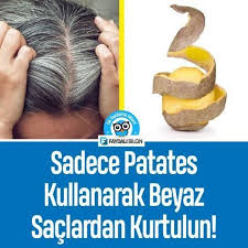 Beyaz Saclardan Patates Ile Kurtulun Faydali Bilgin Beyaz Sac Sac Dogal Sac Bakimi