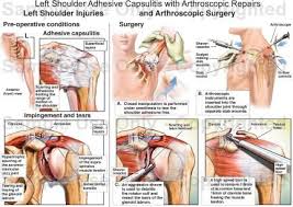 Pin On Fisio Cuello Hombros Brazos