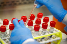 Pemkot Jakarta Utara Siap Laksanakan Rapid Test Covid 19 Republika Online