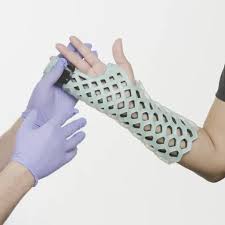 Image result for Ulnar Gutter Splint