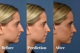 Otolaryngology Associates, P.C.