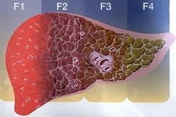 Kogda I Kak Zashishat Pechen Pri Prieme Lekarstv Lekarstvennoe Porazhenie Pecheni