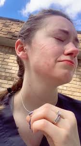 Anna Physical Therapy