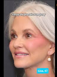 Conjoined Twins, 3, Get Separated in Historic Surgery, See Each Other for  the 1st Time since Birth