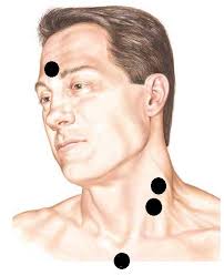 Does EMG monitoring in a CVEMP matter?