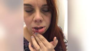 Manspreader' arrested in assault