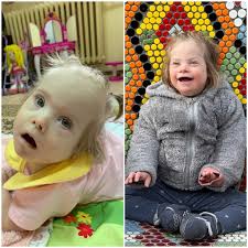 Celebrating Glory Kate's 7th Birthday and Overcoming Special Needs  Challenges