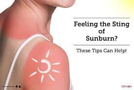 Feeling The Sting Of Sunburn? These Tips Can Help! - By Dr. Amitoj Garg |  Lybrate