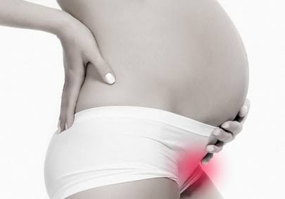 PUBALGIA | IronMommy.cl