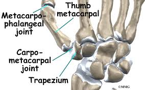 2 years ago2 years ago. Thumb Fusion Surgery Eorthopod Com