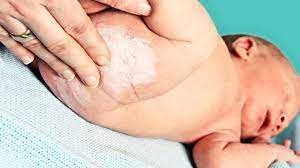Homoopathie Bei Windeldermatitis Wunder Po Soor Netmoms De