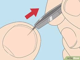 Proven painless way to remove deep or shallow wood, thorn, glass, splinters, pencil lead, thorns, grit, stones, big or small with this hack that really works. How To Remove A Splinter Under Your Fingernail Wikihow