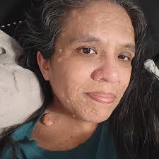 Introduction to kristal with nf1