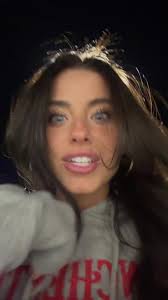 Addy Kate Hair Color Before