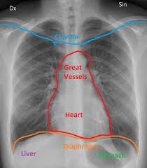 Muscles and tendons information center pictures. Radiology Normal Chest X Rays Glass Box