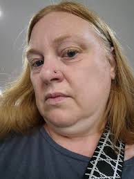 New piercing done 2day does it look ok