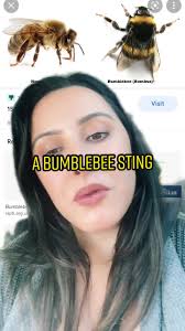 Understanding Bumblebee Stings: Facts and Myths