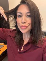 I was currently diagnosed with alopecia (mild as of now) having the gastric  sleeve