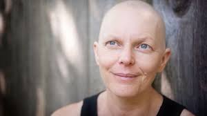 Today, we'll be sharing nature crazy'. Coping With Hair Loss During Chemotherapy