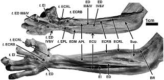 Ligaments connect one bone to another, while tendons connect muscle to bone. 2 Superficial Extensor Muscles And Tendons T Of The Forearm And Download Scientific Diagram