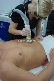Modern technology makes it less painful than before. Colleyville Laser Hair Removal Brazilian Face Underarm Glow