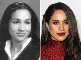 Meghan markle • duchess of sussex • меган маркл. Meghan Markle Before And After The Skincare Edit Rinoplastia Cirugia Plastica Famosos Nariz Bonita