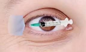 Image result for Lateral Canthotomy