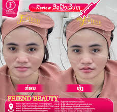 🔥Rewiw ລູກຄ້າຄົບ 1 ເດືອນ 🔥ໂປຮໂມຊັ່ນເປີດສາຂາໃຫມ່ 🔥 ເສີມດັງ2.999.0000ກີບ  📣ສອບຖາມຂໍ້ມູນ ຈອງຄິວ 📍ຄຮີນິກ IRIS FRIEND BEAUTY 🏥ຕັ້ງຢູ່ຫລັກ4 ບ້ານພູຄູນ  ໜ້າTOYOTA ...