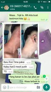 Honey glow soap ialah produk terbaru inovasi terkini.set hilangkan kulit gelap, kusam. Sabun Honey Glow Shopee Malaysia