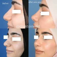 Dr. Antoine Eid MD, PhD