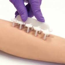 Image result for Skin Testing