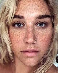 Image result for Freckled skin