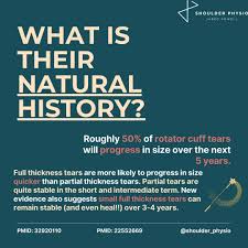 Image result for Shoulder History