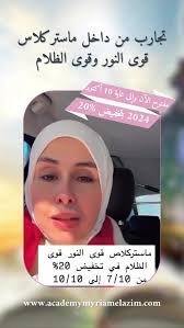 خدمة العملاء عبر التلغرام :...