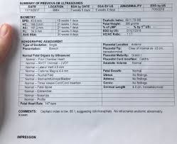 Dolichocephaly Found At 20w Scan Babycenter