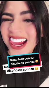 Roxy Nuevos Dientes