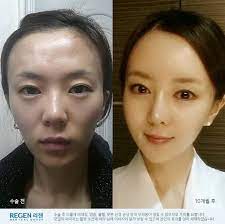 Five women with roots everywhere from south korea to chile and back. Beauty Standards In Korea