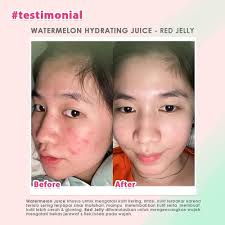 Msglow Juice Merupakan Moisturizer Yang Ketiga Variannya Membantu Melembabkan Kulit Namun Apakah Teman Msglow Sudah Tau Di Setiap Varian Msglo In 2020 Face Baby Face