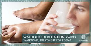 Image result for Edema