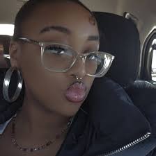 Hey guys!! I'm pretty sure this dermal is totally fine and just irritated ,  but I just wanted y'alls opinions bc idk where to find a professional  piercer let alone a doctor!!