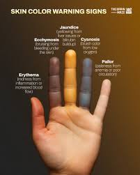Image result for Skin of Color
