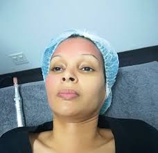 Enhance Aesthetic Clinic