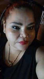 Gato esfinge con heterocromía.