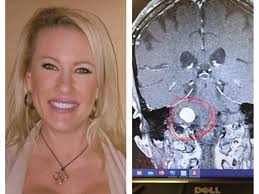 Fundraiser by Jesse Yoder : Jesse's Save The Brain Campaign