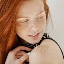 LOVE YOUR FRECKLES DAY