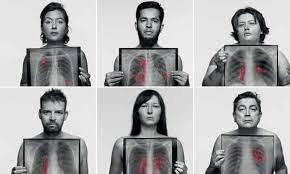 Some mutations occur spontaneously during cell division, they have no external. Gps Urged To Be More Alert In Diagnosing Lung Cancer In Non Smokers Lung Cancer The Guardian