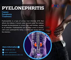 Image result for Acute Pyelonephritis