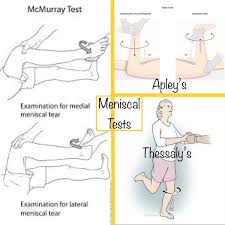 Image result for Thessaly Test