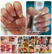 How Many Of You Ladies Have Had To Wait Months For Your Damaged Nails To Grow Out From Having Acrylic Nails Remove Acrylic Nails Dipped Nails Shellac Nail Art